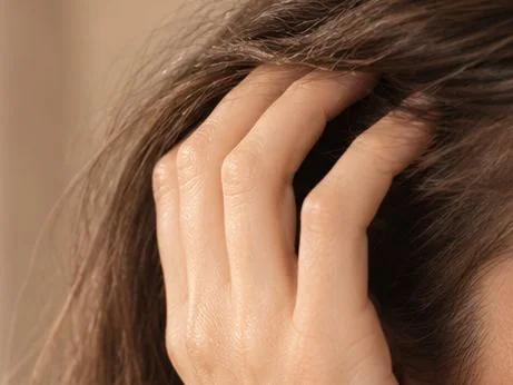Hand an einer empfindlichen Kopfhaut